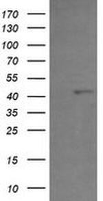 PHF7 Antibody in Western Blot (WB)