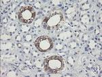 SLA2 Antibody in Immunohistochemistry (Paraffin) (IHC (P))