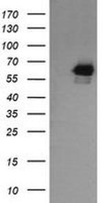 RIOK2 Antibody in Western Blot (WB)