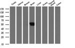 ALX4 Antibody in Western Blot (WB)