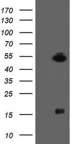 ALX4 Antibody in Western Blot (WB)