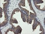 REEP5 Antibody in Immunohistochemistry (Paraffin) (IHC (P))