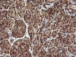 PROSC Antibody in Immunohistochemistry (Paraffin) (IHC (P))