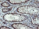 PROSC Antibody in Immunohistochemistry (Paraffin) (IHC (P))