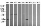 PROSC Antibody in Western Blot (WB)