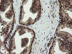 PROSC Antibody in Immunohistochemistry (Paraffin) (IHC (P))