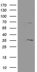 PROSC Antibody in Western Blot (WB)