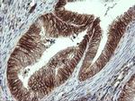 ALX4 Antibody in Immunohistochemistry (Paraffin) (IHC (P))
