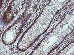 ALX4 Antibody in Immunohistochemistry (Paraffin) (IHC (P))