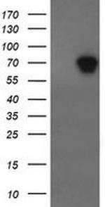 ALX4 Antibody in Western Blot (WB)