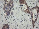 RIOK2 Antibody in Immunohistochemistry (Paraffin) (IHC (P))