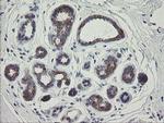 RIOK2 Antibody in Immunohistochemistry (Paraffin) (IHC (P))