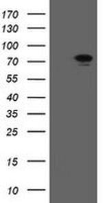 RIOK2 Antibody in Western Blot (WB)