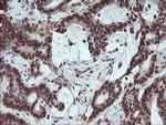 FATE1 Antibody in Immunohistochemistry (Paraffin) (IHC (P))