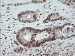 CGI-62 Antibody in Immunohistochemistry (Paraffin) (IHC (P))