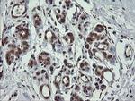 CGI-62 Antibody in Immunohistochemistry (Paraffin) (IHC (P))