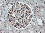 CGI-62 Antibody in Immunohistochemistry (Paraffin) (IHC (P))