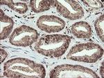 CGI-62 Antibody in Immunohistochemistry (Paraffin) (IHC (P))