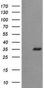 CGI-62 Antibody in Western Blot (WB)