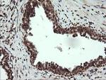 CGI-62 Antibody in Immunohistochemistry (Paraffin) (IHC (P))
