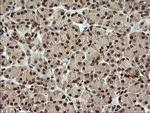 CGI-62 Antibody in Immunohistochemistry (Paraffin) (IHC (P))