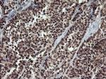 CGI-62 Antibody in Immunohistochemistry (Paraffin) (IHC (P))
