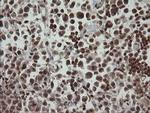 CGI-62 Antibody in Immunohistochemistry (Paraffin) (IHC (P))