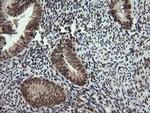 CGI-62 Antibody in Immunohistochemistry (Paraffin) (IHC (P))