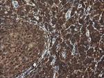 CGI-62 Antibody in Immunohistochemistry (Paraffin) (IHC (P))