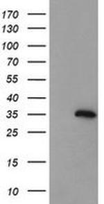 CGI-62 Antibody in Western Blot (WB)