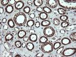 CGI-62 Antibody in Immunohistochemistry (Paraffin) (IHC (P))