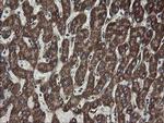 CGI-62 Antibody in Immunohistochemistry (Paraffin) (IHC (P))