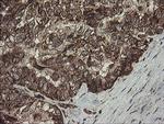CGI-62 Antibody in Immunohistochemistry (Paraffin) (IHC (P))