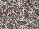 CGI-62 Antibody in Immunohistochemistry (Paraffin) (IHC (P))