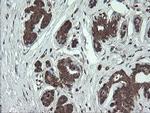 CGI-62 Antibody in Immunohistochemistry (Paraffin) (IHC (P))