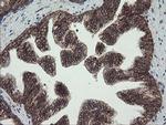 CGI-62 Antibody in Immunohistochemistry (Paraffin) (IHC (P))