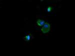 NDUFB10 Monoclonal Antibody (OTI4F1)