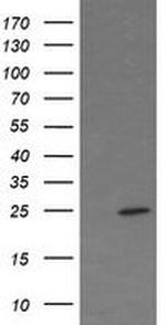 FATE1 Antibody in Western Blot (WB)