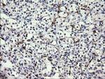 FATE1 Antibody in Immunohistochemistry (Paraffin) (IHC (P))