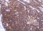 LRCH4 Antibody in Immunohistochemistry (Paraffin) (IHC (P))