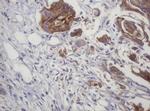 LRCH4 Antibody in Immunohistochemistry (Paraffin) (IHC (P))