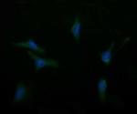 ASGR2 Monoclonal Antibody (OTI4B6)