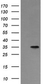 ASGR2 Antibody in Western Blot (WB)