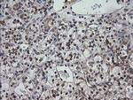 CESK1 Antibody in Immunohistochemistry (Paraffin) (IHC (P))