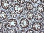 CESK1 Antibody in Immunohistochemistry (Paraffin) (IHC (P))