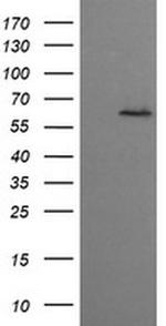 CESK1 Antibody in Western Blot (WB)