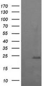 RAB37 Antibody in Western Blot (WB)