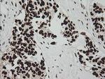 ZNF447 Antibody in Immunohistochemistry (Paraffin) (IHC (P))