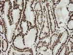 ZNF447 Antibody in Immunohistochemistry (Paraffin) (IHC (P))