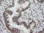 ZNF447 Antibody in Immunohistochemistry (Paraffin) (IHC (P))
